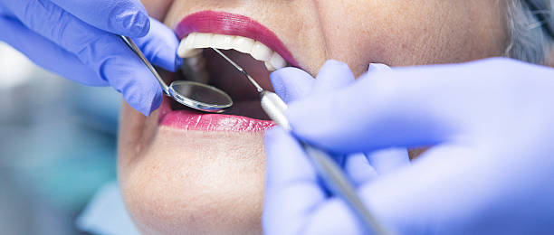 Best Knocked-Out Tooth (Avulsed Tooth) Treatment in Soddy Daisy, TN